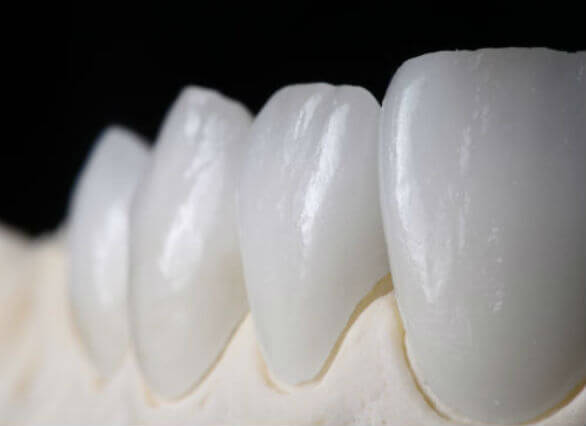 How to straighten your teeth without braces